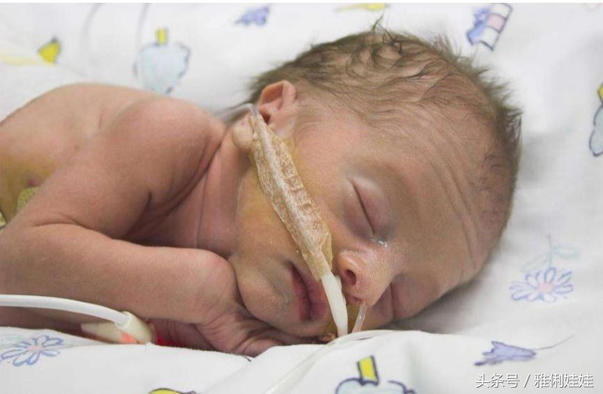 前置胎盘老是出血能保胎到足月吗,中央型胎盘前置保胎经历