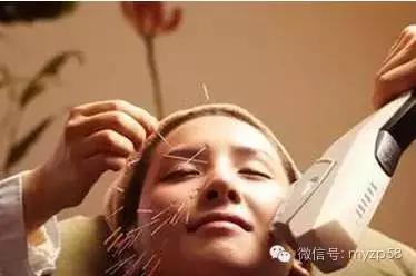 美容师针清手法,脸部打美容针的手法