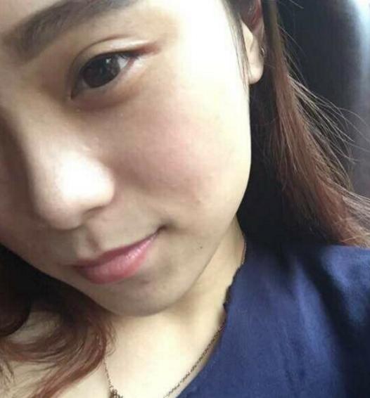 男人脸上长斑怎么办如何快速祛斑,老年人脸上祛斑美白