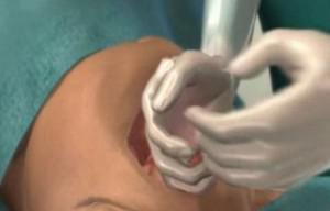 分娩时进行“剖腹产”手术全过程（附图）