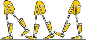 截瘫步行矫形器在脊髓损伤康复中的应用