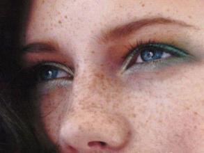 听说过小时候打鸟会得*褐斑黄**吗？3款膳食，教你如何去除*褐斑黄**