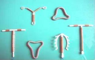 取环详细手术记录,取环术手术步骤