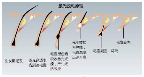 家用激光脱毛仪全测评,家用脱毛仪推荐品牌