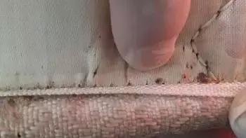 突然宝宝身上起了很多疙瘩奇痒,宝宝全身起密密麻麻小疙瘩很痒