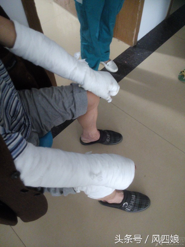 伤口10天了有必要再打破伤风针吗,受伤后多久时间内打破伤风针合适