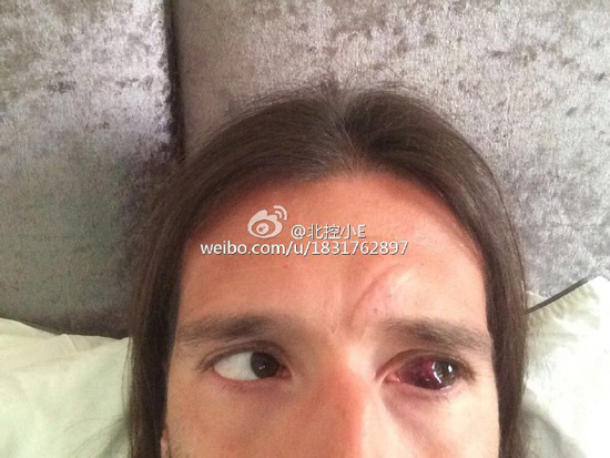 涓敳璧涘満鎯婄幇鏆村姏椋炶腹鐘,涓敳鑱旇禌鐖嗗彂鍐茬獊涓や汉鏌撶孩