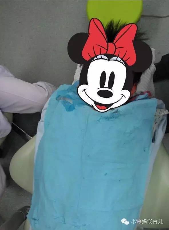 儿童乳牙龋齿烂了有必要补牙吗,乳牙蛀了是套牙套还是补牙