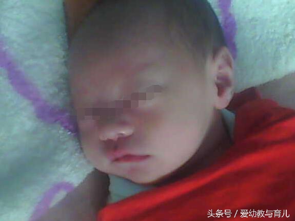 单亲孕妈流产,35宝妈四次剖腹产的经历