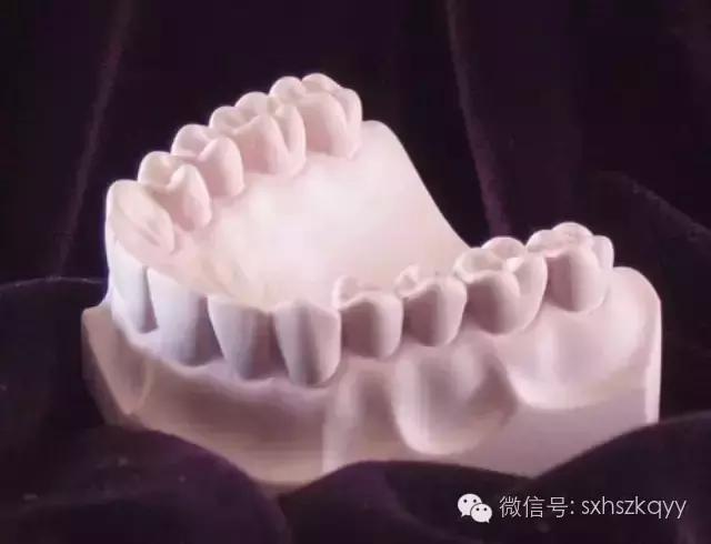 常见排齐牙齿的四大方法,牙齿拥挤重叠矫正过程