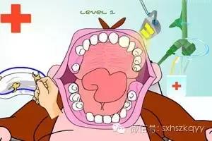 常见排齐牙齿的四大方法,牙齿拥挤重叠矫正过程