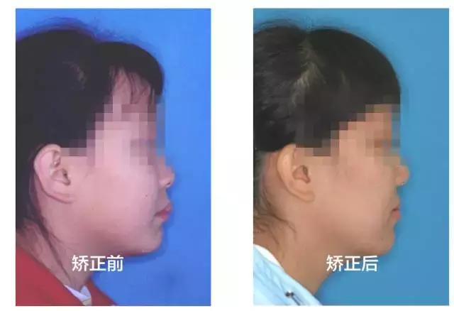 正畸专家介绍图,正畸医生关于整牙的10条建议