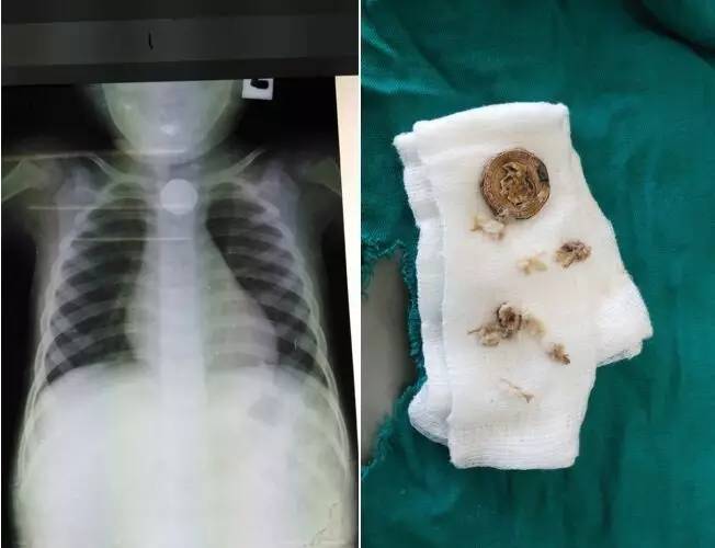 万里之外的桑给巴尔，有这么一群无锡的“白衣天使”