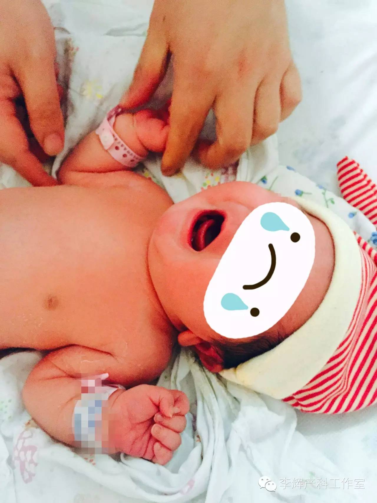 新生儿为什么会锁骨骨折,顺产宝宝锁骨骨折的原因