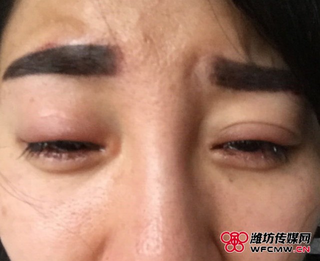 纹美瞳线后眼睛瞎了,纹了美瞳线眼睛模糊