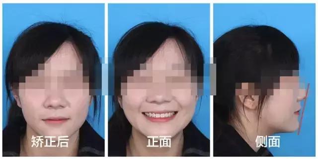 正畸专家介绍图,正畸医生关于整牙的10条建议