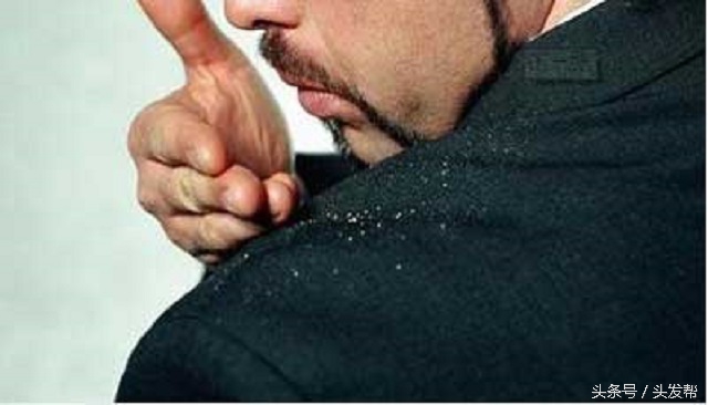 为什么用了防脱发洗发水还掉头发,使用防脱发洗发水掉头发怎么回事