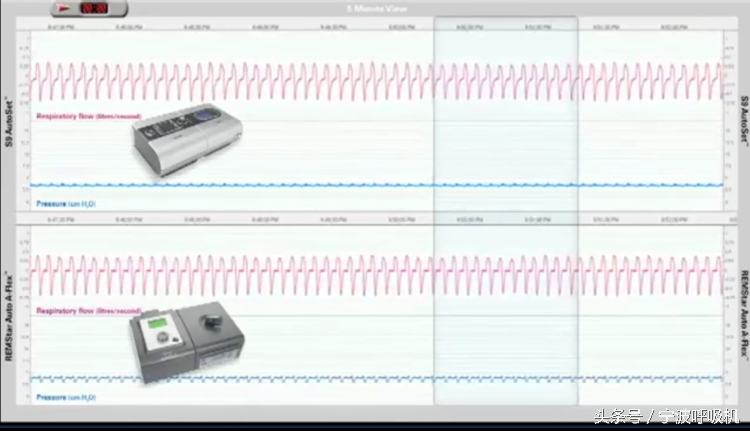 瑞思迈s9autoset-s的价格,瑞思迈s9autoset-s评测
