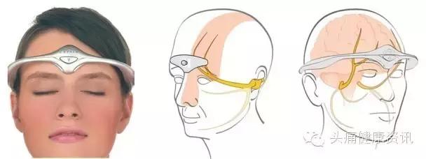 美国治偏头痛最新药物价格,偏头痛美国新药