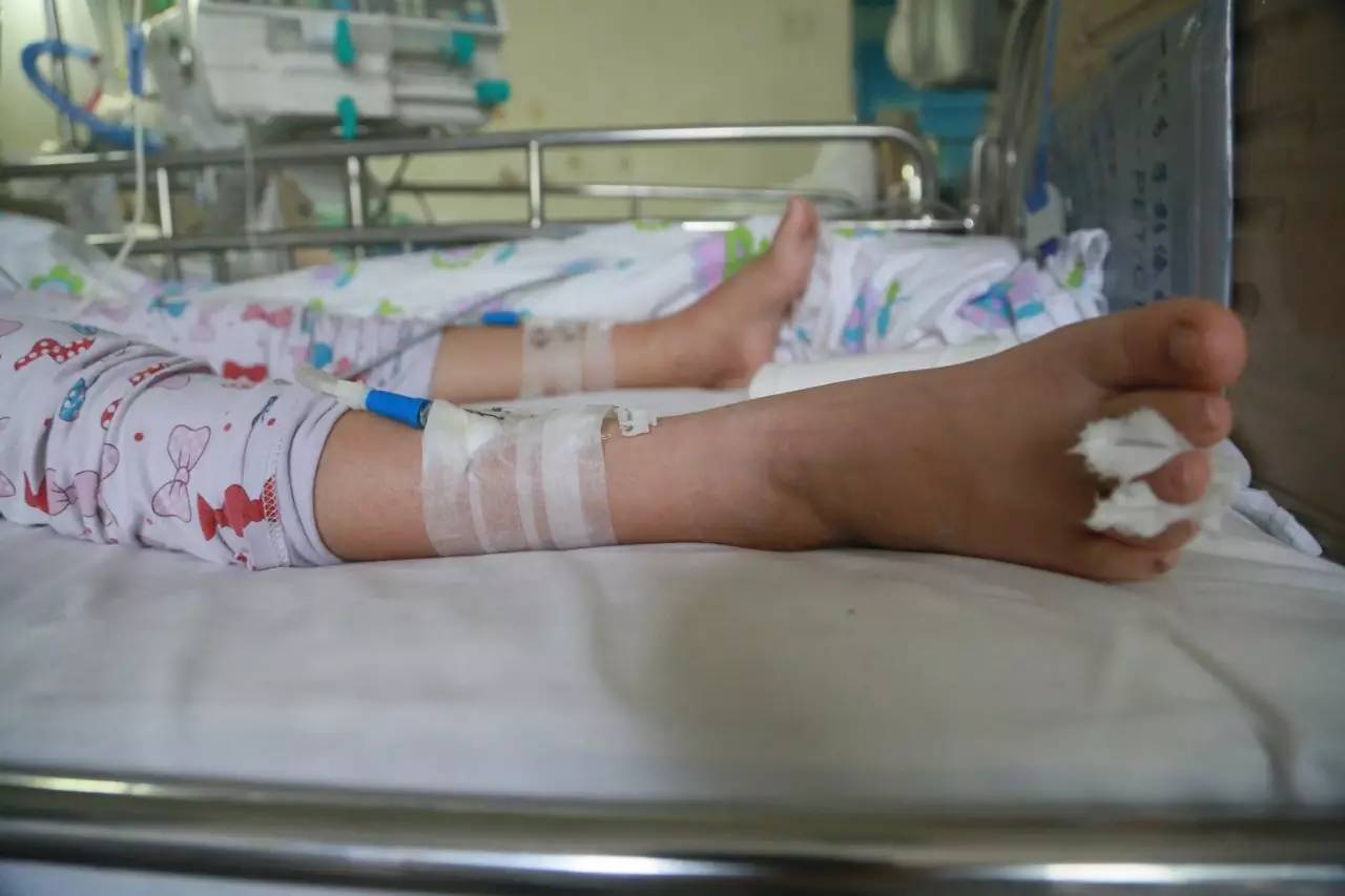 神经外科癫痫手术能根治吗,神经外科大夫治疗癫痫的方法