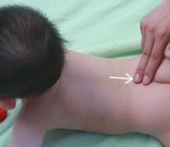 孩子起口疮小儿推拿,小儿推拿嘴角口疮