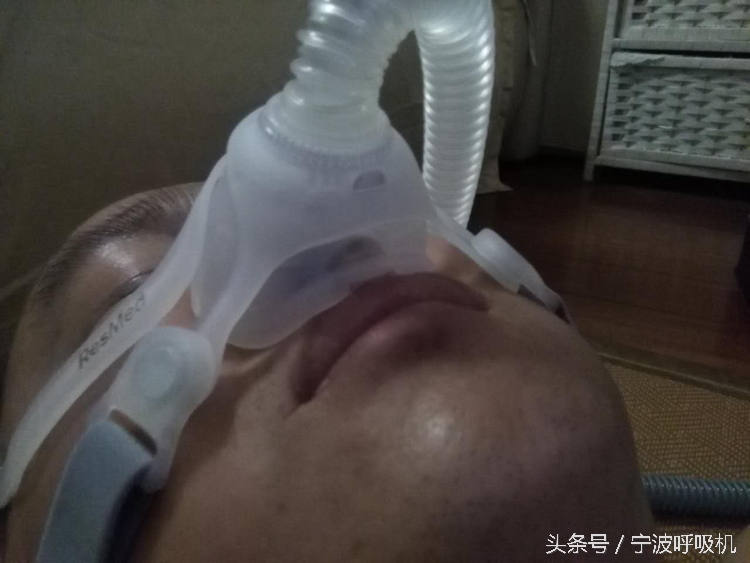瑞思迈呼吸机s10面罩怎么选,瑞思迈呼吸机n20鼻罩怎么戴才舒服
