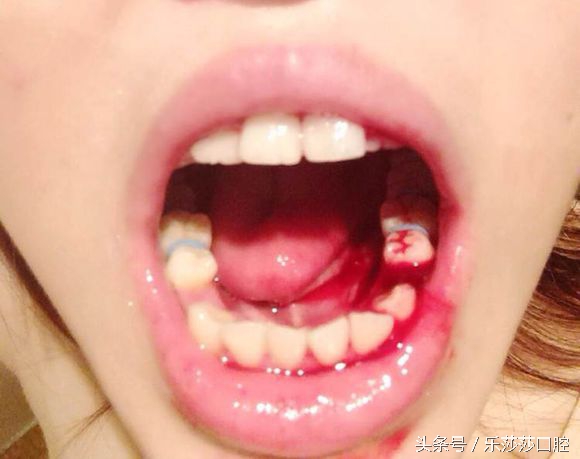 看牙医必问的5个问题,看牙医能快速止痛吗