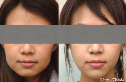 刮痧的基础知识,你所不知道的关于刮痧的秘密