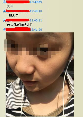 不用花钱的美白淡斑方法,牛奶淡斑面膜的做法