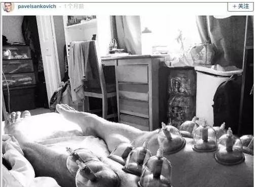 作为一个有同样爱好的老陕我必须提醒菲尔普斯:拔罐后不能下水！