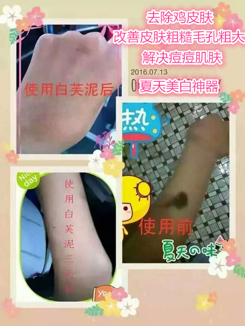 男去黑头最有效的方法,男士去黑头的最有效的方法