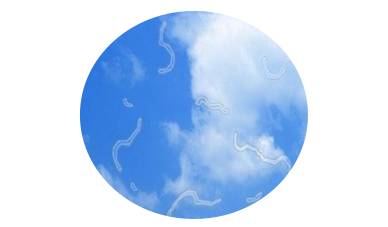 眼睛看东西有蚊子飞是怎么回事,眼前有蚊子飞的影子啥原因