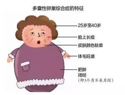 多囊卵巢综合症不治可以怀孕吗,多囊卵巢综合征是不治之症吗