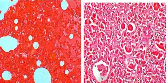 “热死了热死了”，人真的会热死吗？