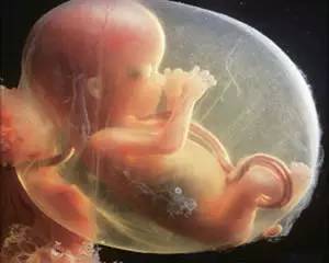 单脐动脉孕妈注意事项,单脐动脉的孕妈可以运动吗