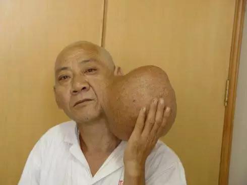 被春晚吉祥物丑哭了，那谜一样的「耳下两坨」难道不是腮腺肿物？