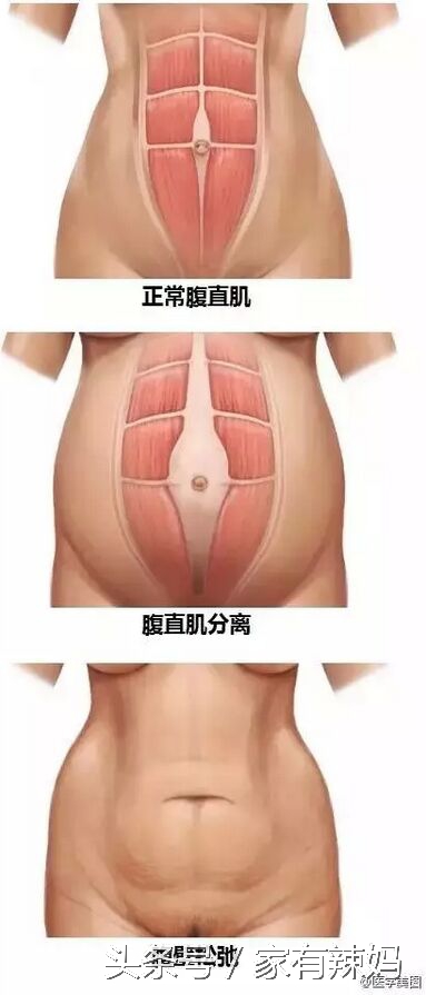 产后瘦身运动完整版,有效的产后瘦身