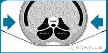 bioskin泰国哪里有卖,bioskin涂抹式水光针测评