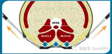 bioskin泰国哪里有卖,bioskin涂抹式水光针测评