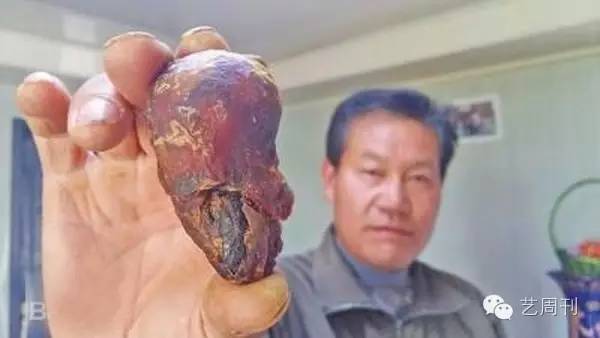 天价鸡宝骗局,传说中的天价鸡宝