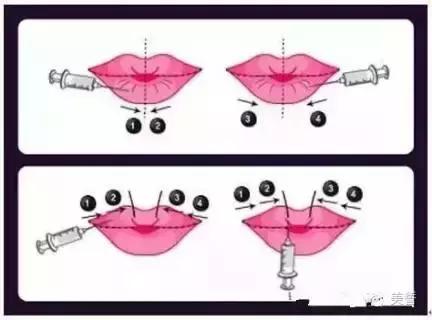 唇唇欲动攻略,唇部拯救你的唇形