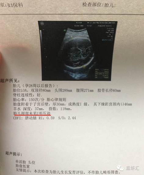 产科b超报告怎么看是否需要清宫,怎么看懂产检b超单