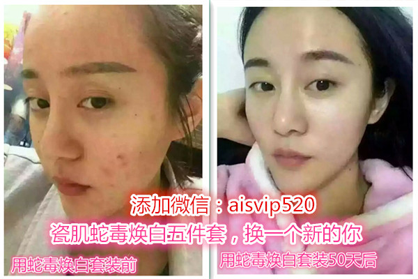 瓷肌去除黑头好不好,瓷肌去黑头三件套