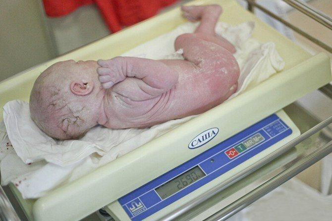 剖腹产为什么医生建议39周剖腹产,剖腹产后最常见的三个后遗症