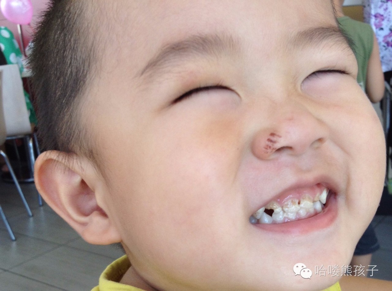 滚蛋吧耐药菌,滚蛋吧拖延症