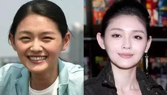 不用整容使鼻子变高挺,鼻子变高整容