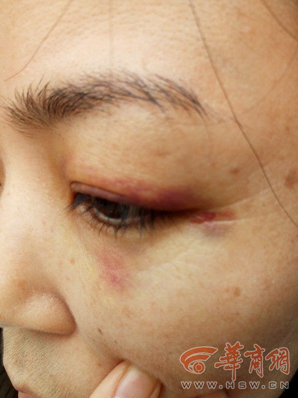 一女子商场撞到玻璃,女子逛街撞到玻璃