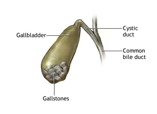吃卵磷脂的好处和坏处是什么 (药用卵磷脂和保健卵磷脂有啥区别)
