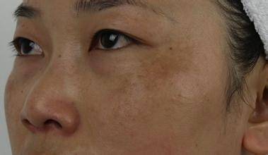 美白丸哪个牌子好六款美白丸推荐,安全有效的美白丸测评