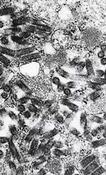 《釜山行》里的丧尸，现实中会出现吗？